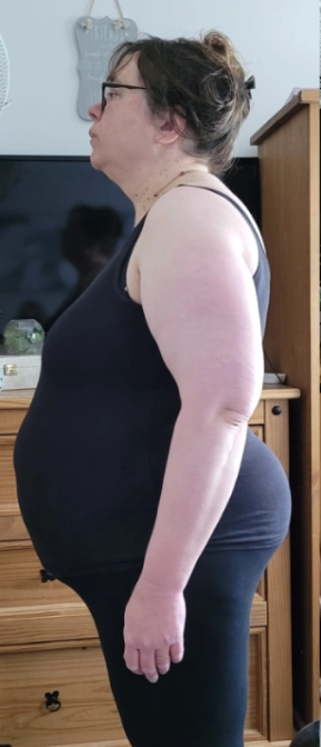 Client before weight loss